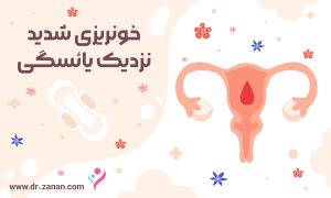 درمان خونریزی شدید قبل از یائسگی