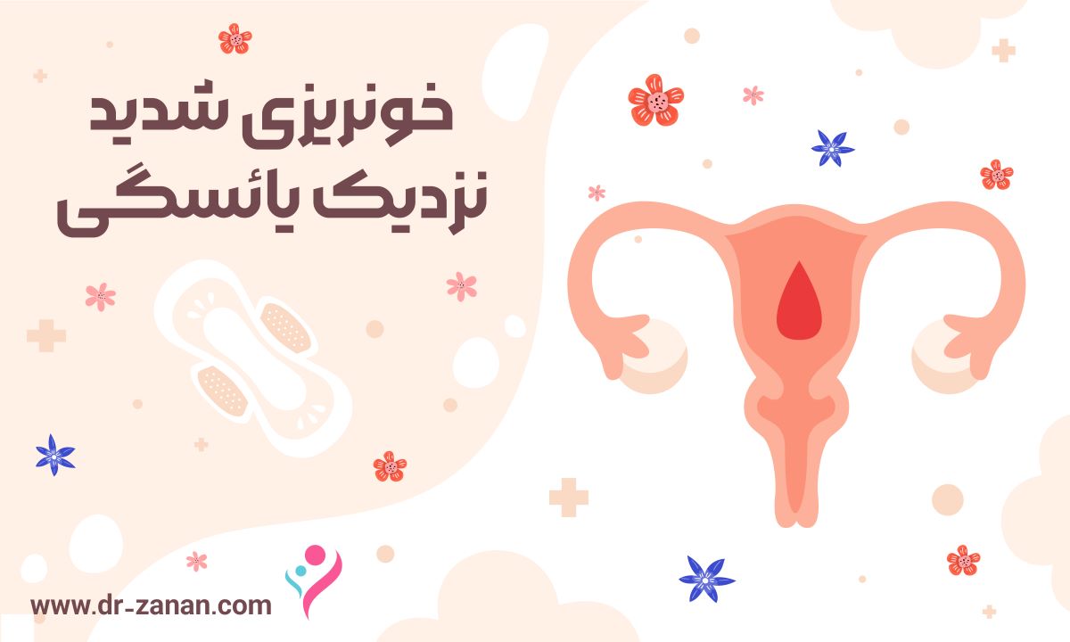 درمان خونریزی شدید قبل از یائسگی