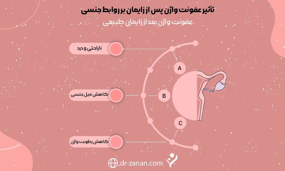 عفونت واژن بعد از زایمان طبیعی