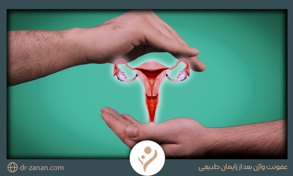 عفونت واژن بعد از زایمان طبیعی