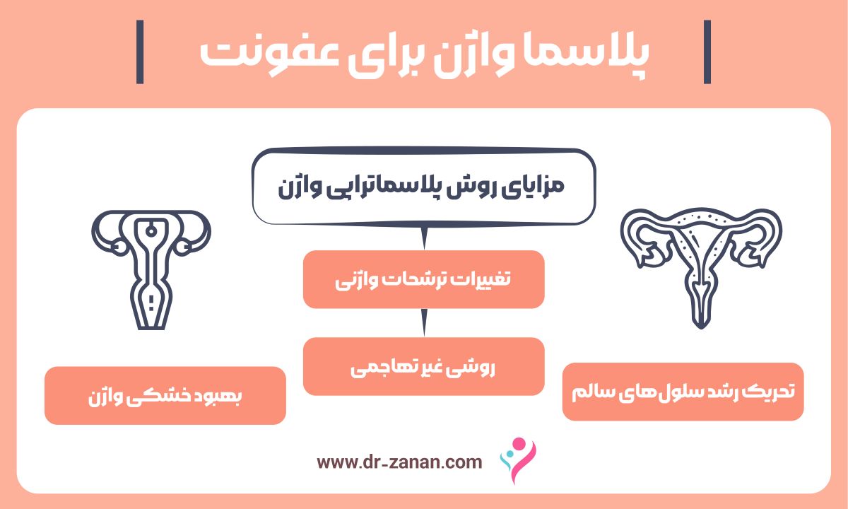 پلاسما واژن برای عفونت