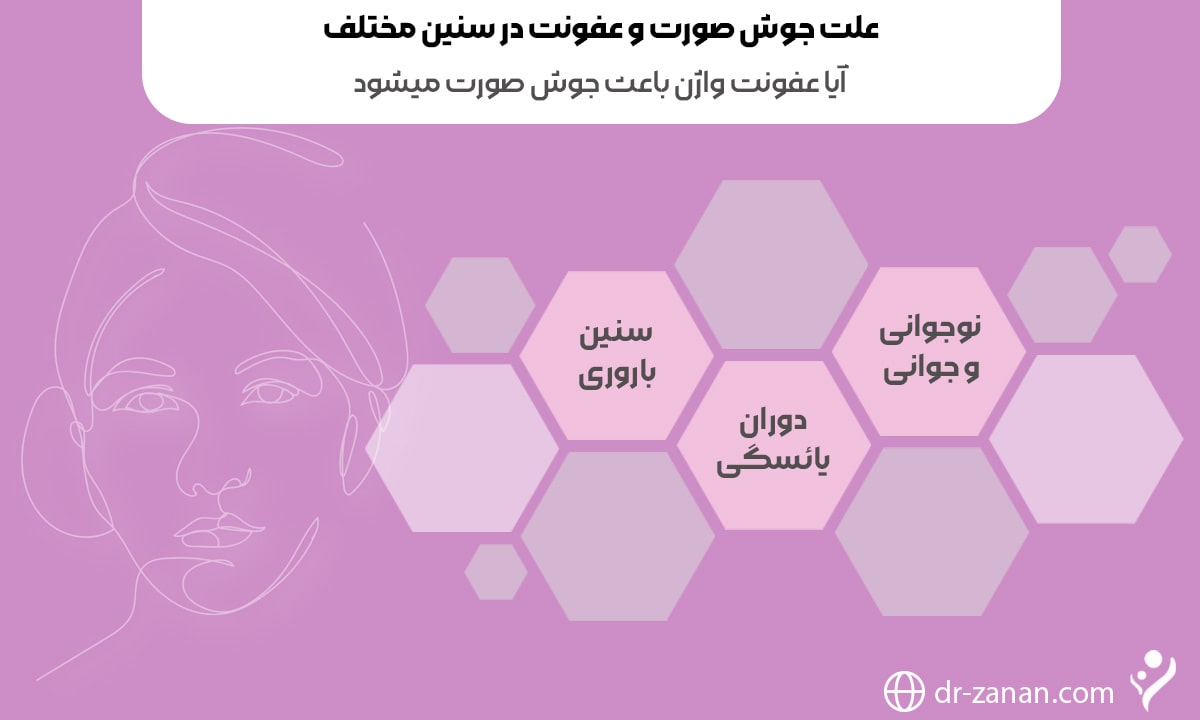 آیا عفونت واژن باعث جوش صورت میشود