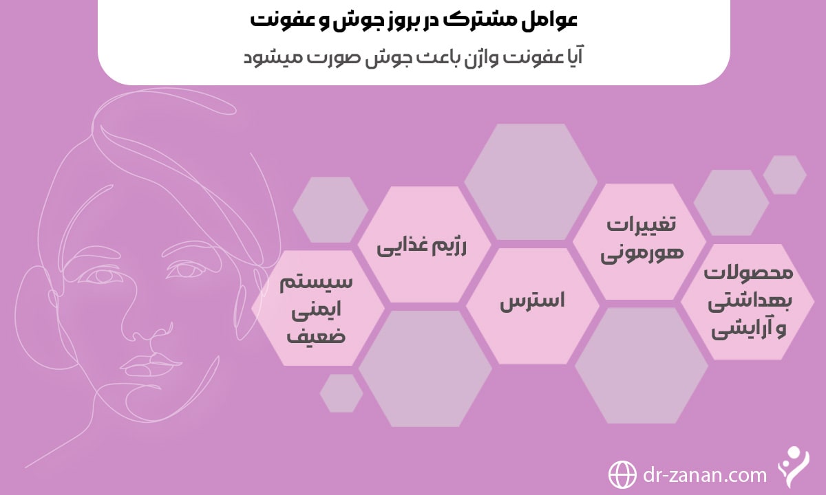 آیا عفونت واژن باعث جوش صورت میشود