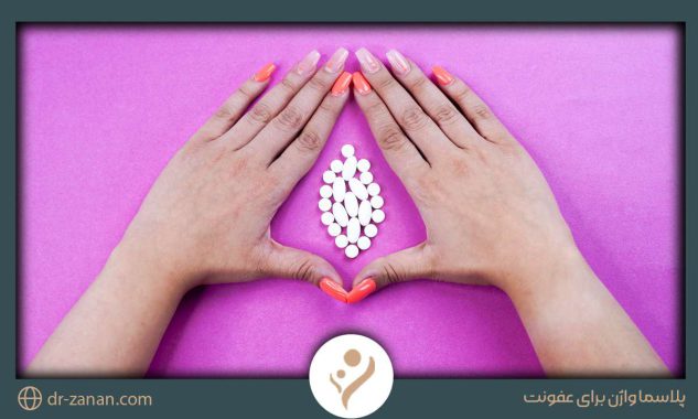 پلاسما واژن برای عفونت