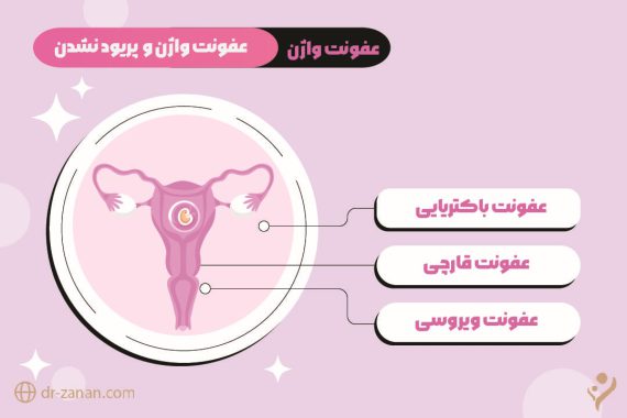 عفونت واژن و پریود نشدن